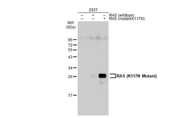 Anti-RAS (K117N Mutant) antibody used in Western Blot (WB). GTX132416