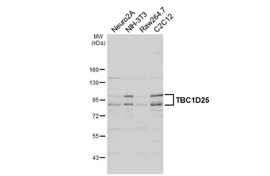 Anti-TBC1D25 antibody used in Western Blot (WB). GTX132577