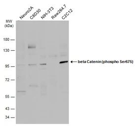 Anti-beta Catenin (phospho Ser675) antibody used in Western Blot (WB). GTX132611