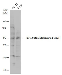 Anti-beta Catenin (phospho Ser675) antibody used in Western Blot (WB). GTX132611