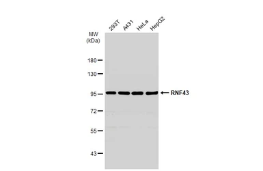Anti-RNF43 antibody used in Western Blot (WB). GTX132671