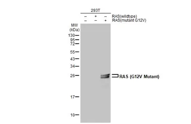Anti-RAS (G12V Mutant) antibody used in Western Blot (WB). GTX132694