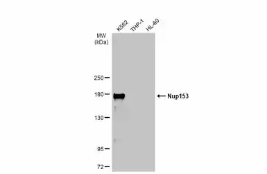Anti-Nup153 antibody used in Western Blot (WB). GTX132731