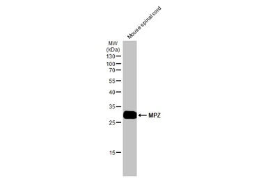 Anti-MPZ antibody used in Western Blot (WB). GTX132747