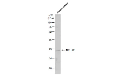 Anti-NPHS2 antibody used in Western Blot (WB). GTX132753