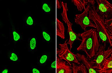 Anti-hnRNP L antibody used in Immunocytochemistry/ Immunofluorescence (ICC/IF). GTX132754