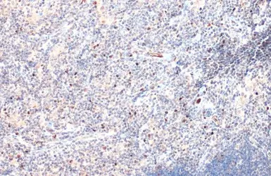 Anti-TBR2 / Eomes antibody used in IHC (Paraffin sections) (IHC-P). GTX132776