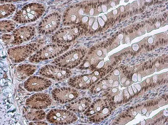 Anti-PDCD4 (phospho Ser457) antibody used in IHC (Paraffin sections) (IHC-P). GTX132798