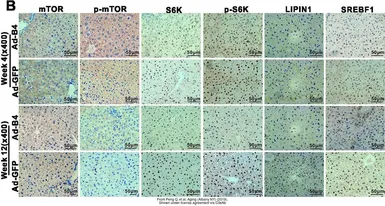 Anti-mTOR (phospho Ser2448) antibody used in IHC (Paraffin sections) (IHC-P). GTX132803