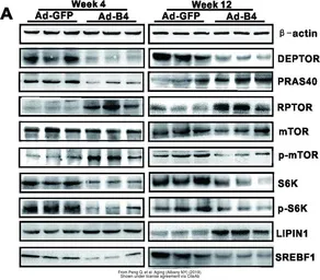 Anti-mTOR (phospho Ser2448) antibody used in Western Blot (WB). GTX132803
