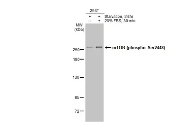 Anti-mTOR (phospho Ser2448) antibody used in Western Blot (WB). GTX132803