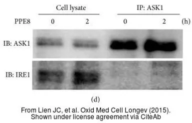 Anti-IRE1 alpha (phospho Ser724) antibody used in Western Blot (WB). GTX132808