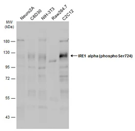 Anti-IRE1 alpha (phospho Ser724) antibody used in Western Blot (WB). GTX132808