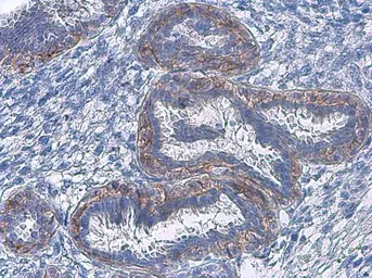 Anti-EGFR (phospho Tyr1068) antibody used in IHC (Paraffin sections) (IHC-P). GTX132810