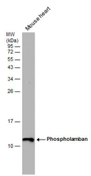 Anti-Phospholamban antibody used in Western Blot (WB). GTX132854