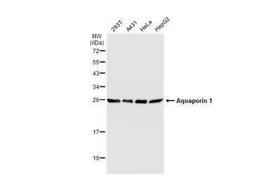 Anti-Aquaporin 1 antibody used in Western Blot (WB). GTX132870