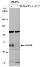 Anti-MMP14 antibody used in Western Blot (WB). GTX132884