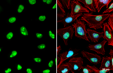 Anti-Nucleolin antibody used in Immunocytochemistry/ Immunofluorescence (ICC/IF). GTX132891