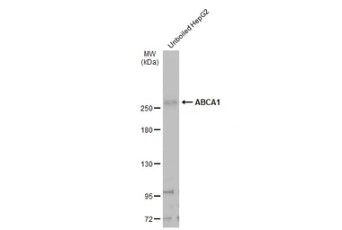 Anti-ABCA1 antibody used in Western Blot (WB). GTX132946