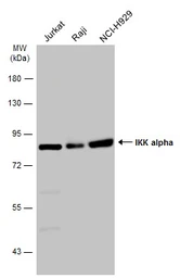 Anti-IKK alpha antibody used in Western Blot (WB). GTX132964