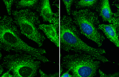 Anti-Clathrin Heavy chain antibody used in Immunocytochemistry/ Immunofluorescence (ICC/IF). GTX132976