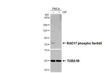 Anti-Rad17 (phospho Ser645) antibody used in Western Blot (WB). GTX133005