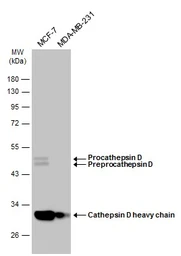 Anti-Cathepsin D antibody used in Western Blot (WB). GTX133019