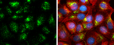 Anti-Cathepsin D antibody used in Immunocytochemistry/ Immunofluorescence (ICC/IF). GTX133019