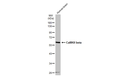 Anti-CaMKII beta antibody used in Western Blot (WB). GTX133072