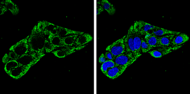 Anti-IDH2 antibody used in Immunocytochemistry/ Immunofluorescence (ICC/IF). GTX133078
