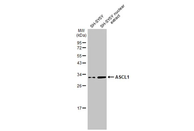 Anti-ASCL1 antibody used in Western Blot (WB). GTX133105