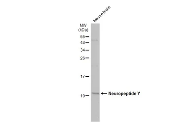 Anti-Neuropeptide Y antibody used in Western Blot (WB). GTX133138