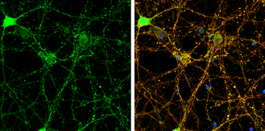 Anti-PSD95 antibody used in Immunocytochemistry/ Immunofluorescence (ICC/IF). GTX133167