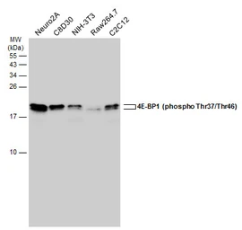 Anti-4E-BP1 (phospho Thr37/Thr46) antibody used in Western Blot (WB). GTX133182