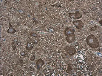 Anti-MAP1B antibody used in IHC (Paraffin sections) (IHC-P). GTX133209
