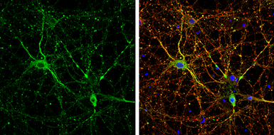 Anti-MAP1B antibody used in Immunocytochemistry/ Immunofluorescence (ICC/IF). GTX133209
