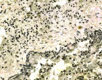 Anti-IL21 Receptor antibody used in Immunohistochemistry (IHC). GTX13321