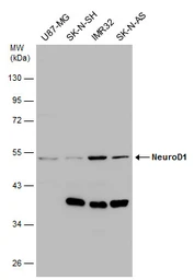 Anti-NeuroD1 antibody used in Western Blot (WB). GTX133214