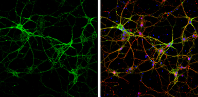 Anti-NCAM antibody used in Immunocytochemistry/ Immunofluorescence (ICC/IF). GTX133217