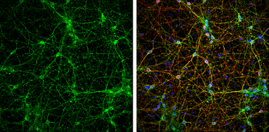 Anti-VAMP2 antibody used in Immunocytochemistry/ Immunofluorescence (ICC/IF). GTX133241
