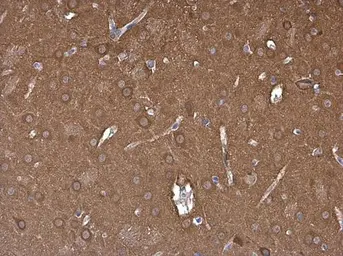 Anti-NSE antibody used in IHC (Paraffin sections) (IHC-P). GTX133249
