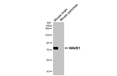 Anti-WAVE1 antibody used in Western Blot (WB). GTX133263