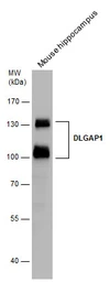 Anti-DLGAP1 antibody used in Western Blot (WB). GTX133264