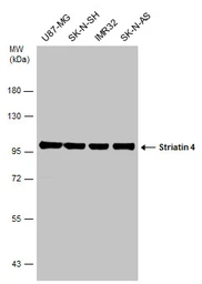 Anti-Striatin 4 antibody used in Western Blot (WB). GTX133282