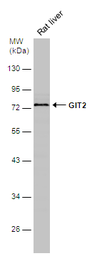 Anti-GIT2 antibody used in Western Blot (WB). GTX133285