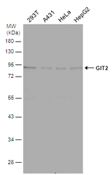 Anti-GIT2 antibody used in Western Blot (WB). GTX133285