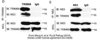 Anti-Zika virus NS3 protein antibody used in Western Blot (WB). GTX133309