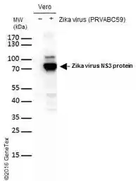 Anti-Zika virus NS3 protein antibody used in Western Blot (WB). GTX133309