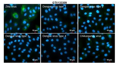 Anti-Zika virus NS3 protein antibody used in Immunocytochemistry/ Immunofluorescence (ICC/IF). GTX133309