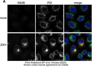 Anti-Zika virus NS4B protein antibody used in Immunocytochemistry/ Immunofluorescence (ICC/IF). GTX133311